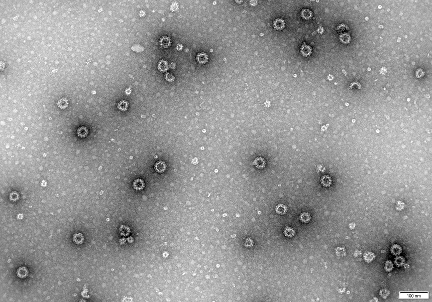 Partículas de norovirus capturadas por microscopía electrónica de transmisión. La barra indica 100 nm.